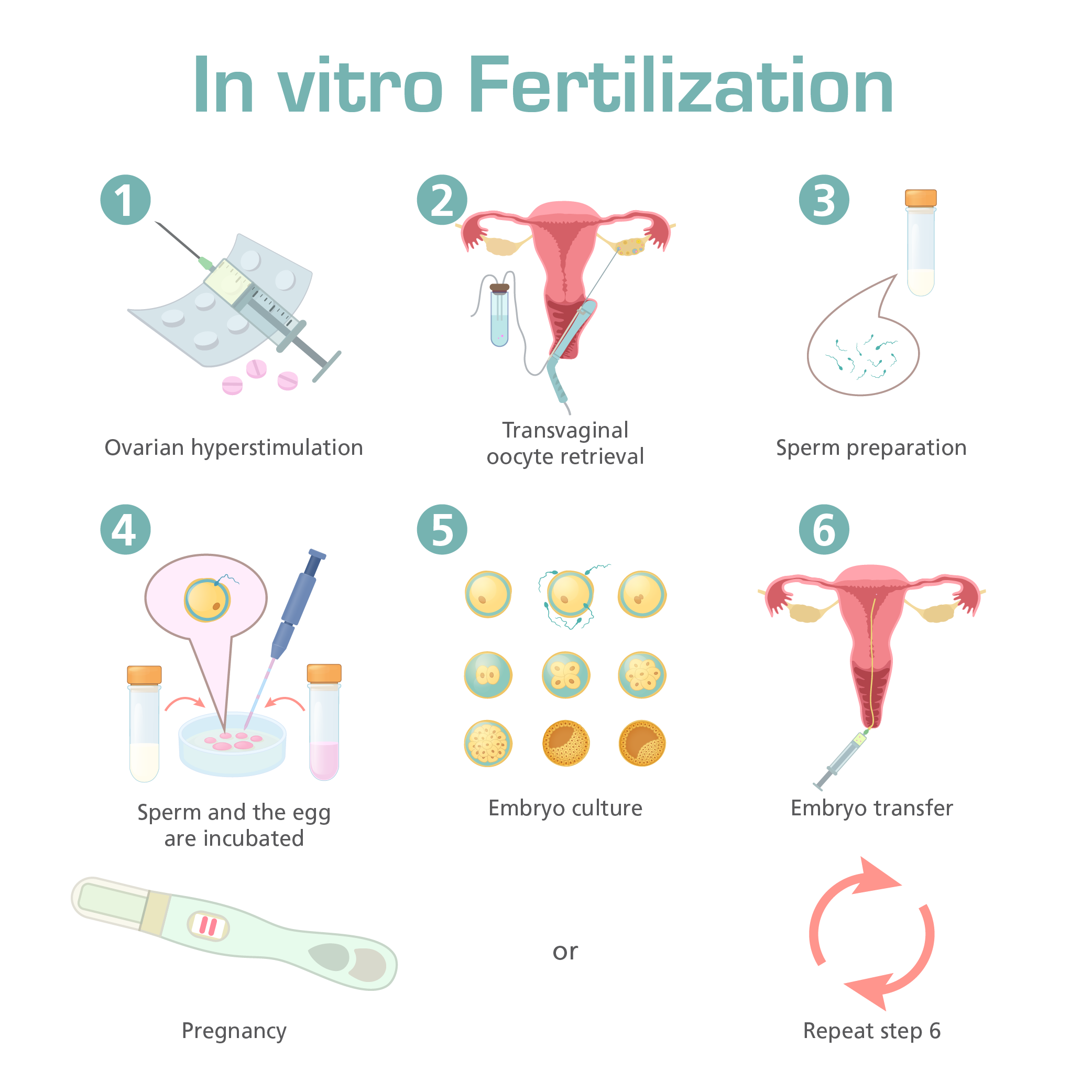 Esco Medical In vitro fertilization  IVF as Fertility 